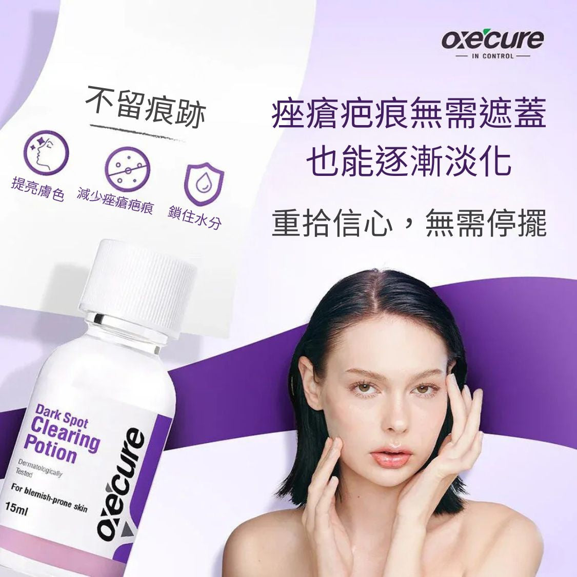 Oxecure Acne and Dark Spot Clearing Potion 15ml