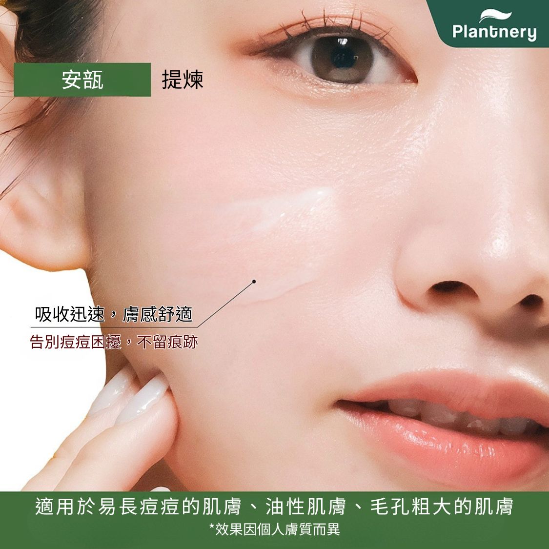 Plantnery 抗痘精華 8ml