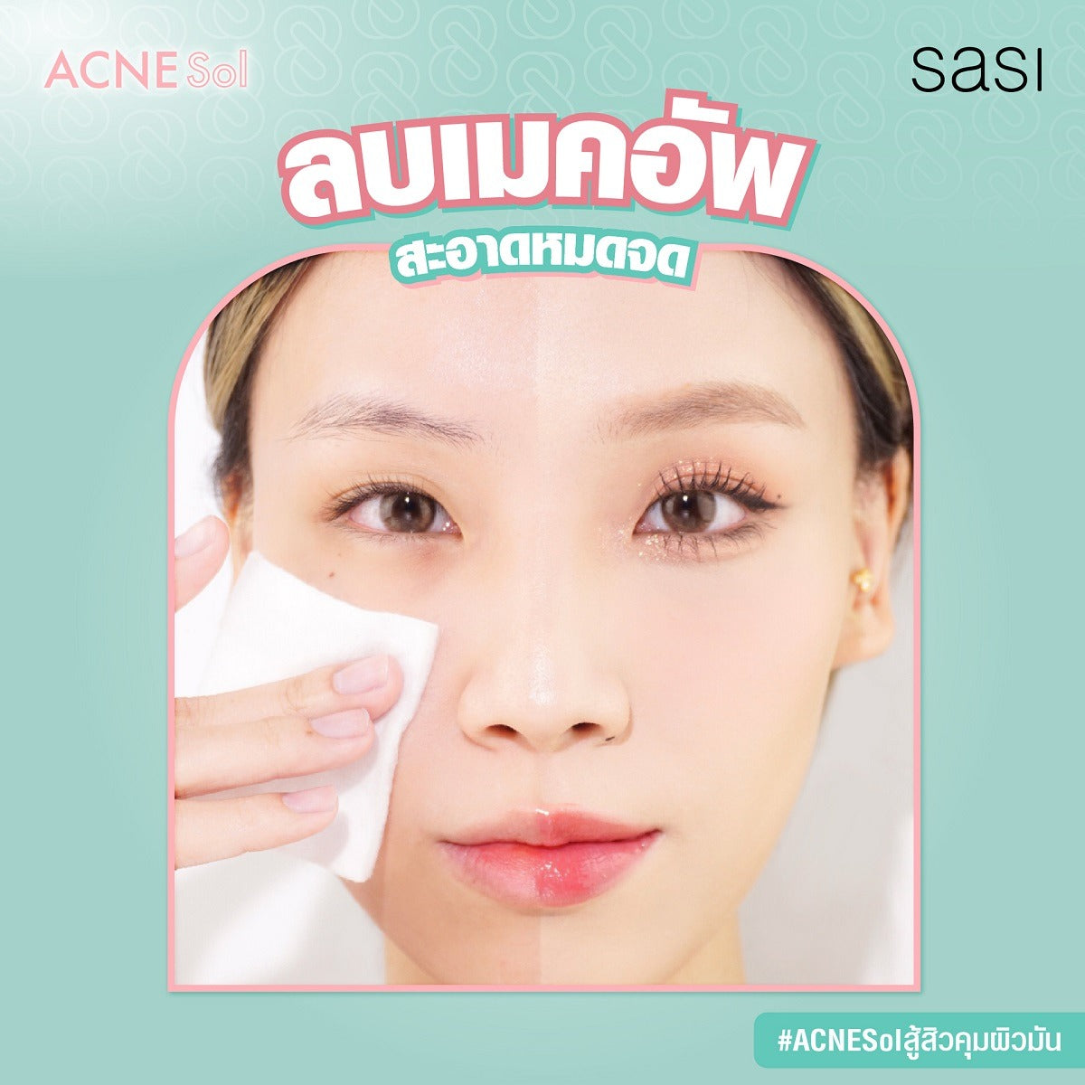 Sasi Anti-Acne Makeup Remover & Cleanser 100ml