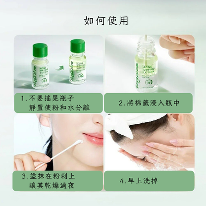 Glad2Glow 祛痘神水 10ml