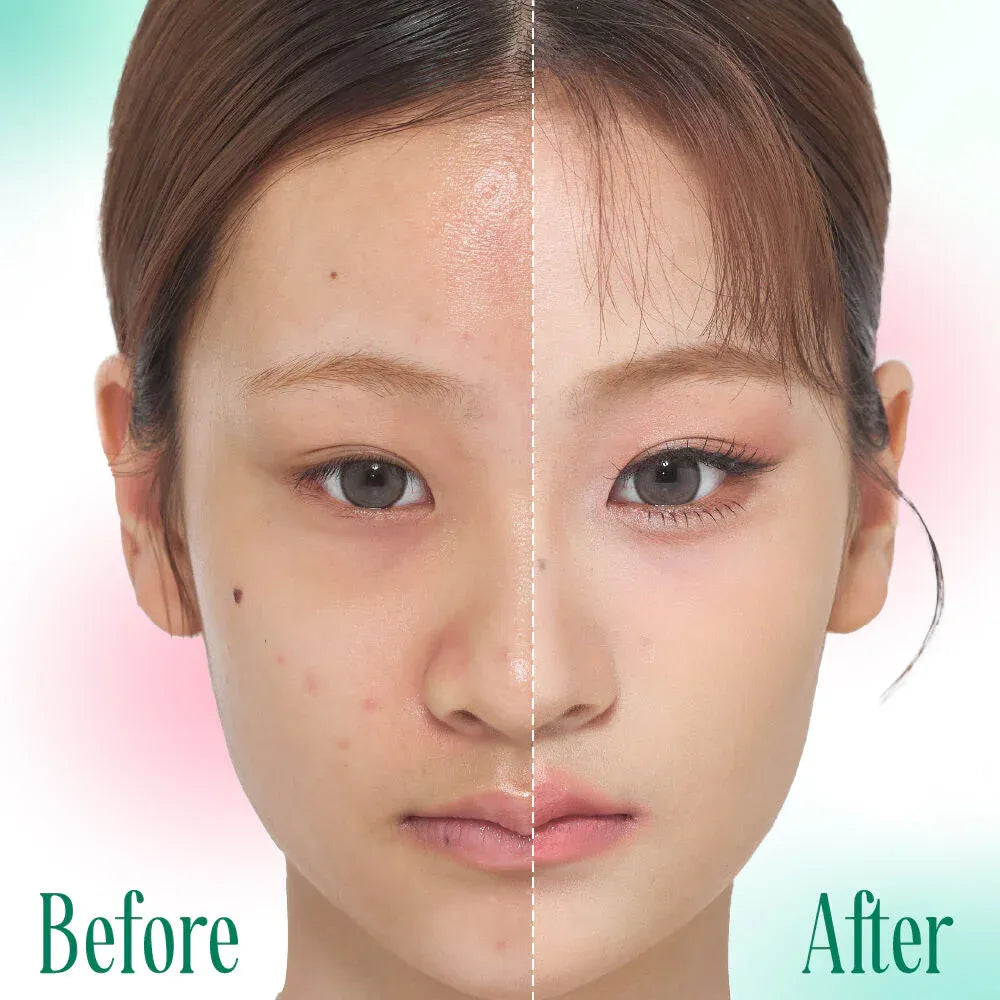 Charmiss 全日啞光抗痘粉底液 SPF50 PA++++ 5g