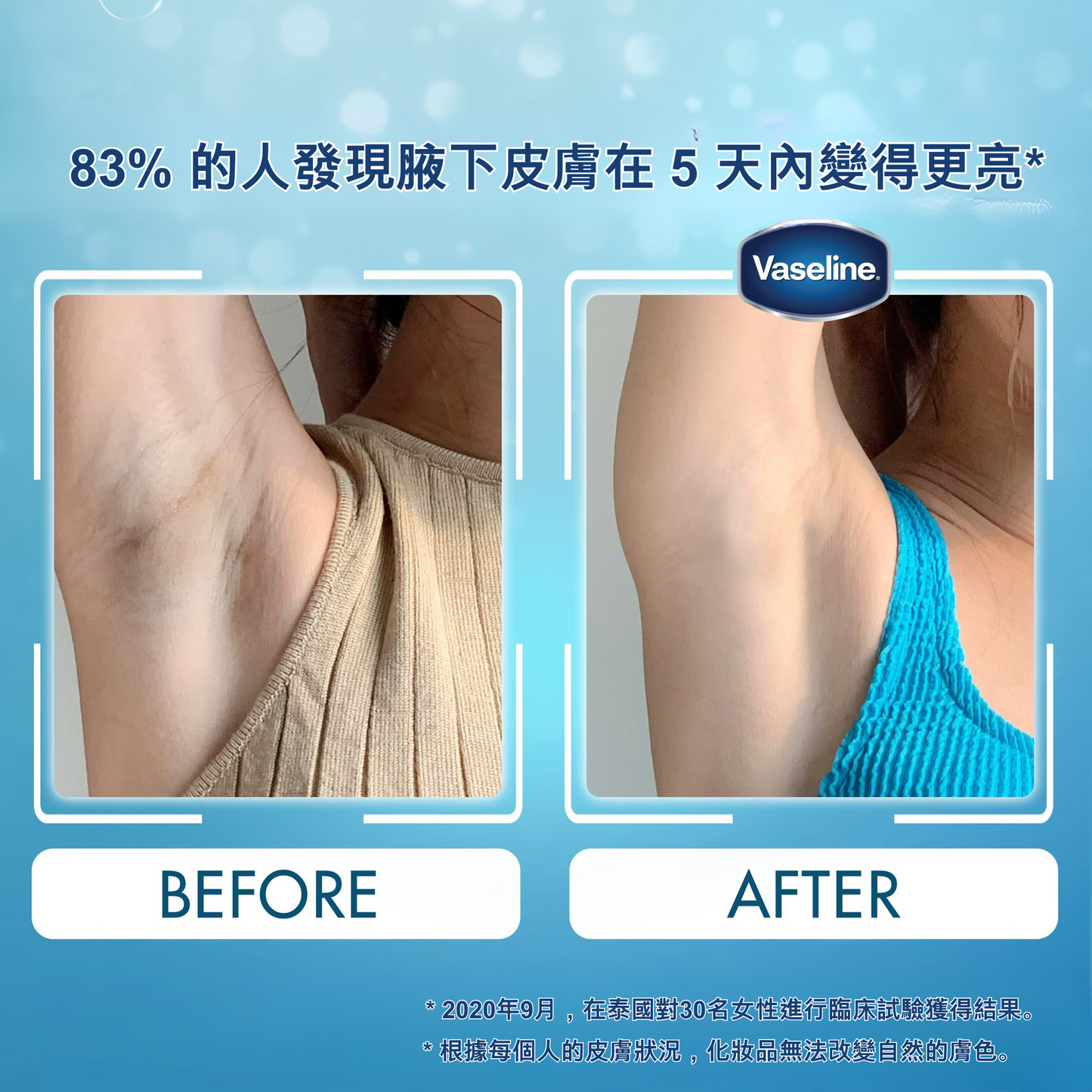 Vaseline Underarm Drying, Whitening, Deodorizing, and Antiperspirant Serum 45ml (4 shades)