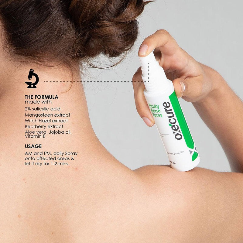 Oxecure 祛痘身體噴霧 25ml